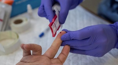 La ANMAT aprobó el test argentino para la detección rápida de covid-19