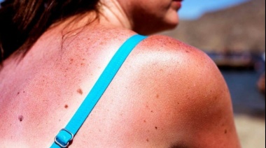 Se termina el verano y tu cuerpo lo sabe: cómo cuidar la piel después de las vacaciones