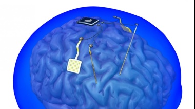 Implantes en el cerebro que ayudan a las personas paralizadas a moverse, hablar y tocar
