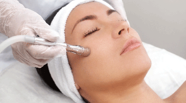 Hablemos de Peeling