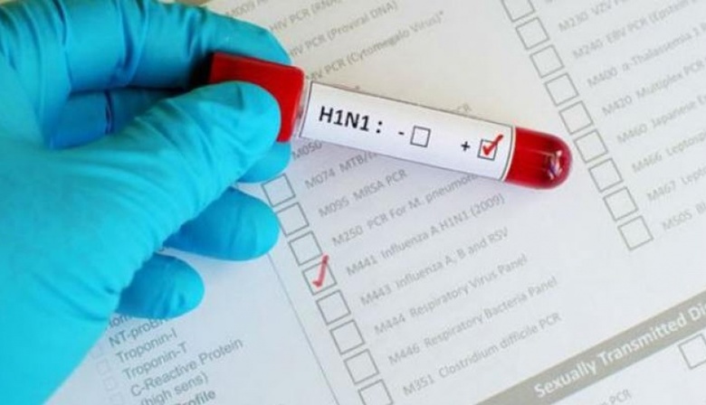Confirman primer caso de Gripe A en la provincia