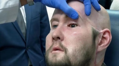 Hito en la medicina: Fue un éxito el primer trasplante de ojo completo en el mundo