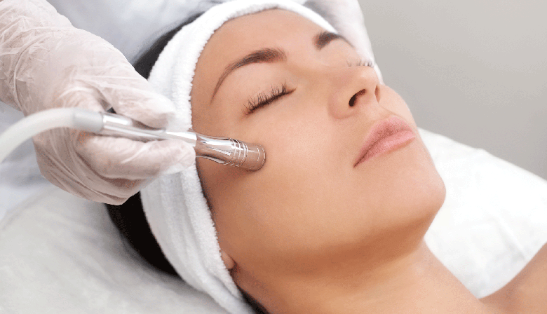 Hablemos de Peeling