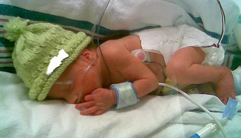 Sin médicos y sin red: el fin de un programa clave para bebés con cardiopatías