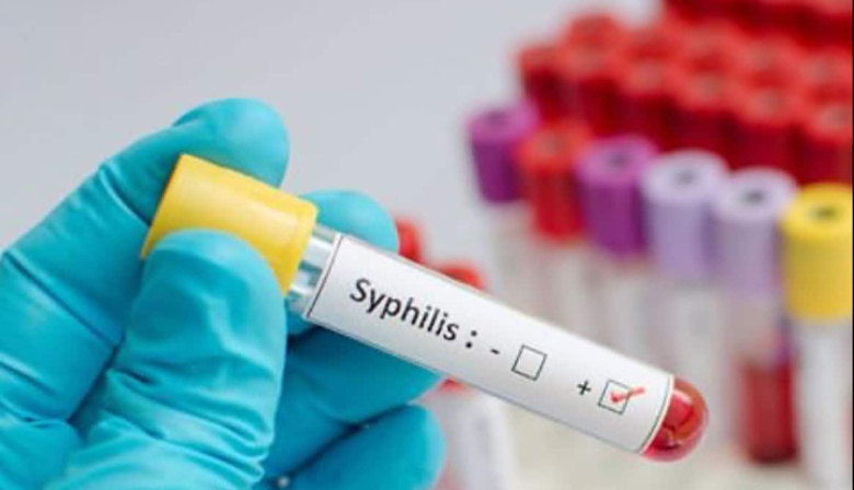 Alerta por el aumento de casos de sífilis en Argentina