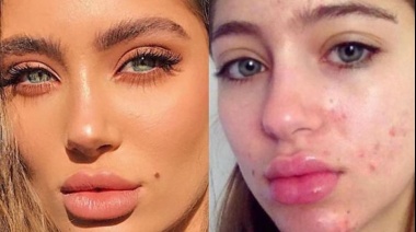 Noruega prohibió los filtros de "belleza" en redes sociales