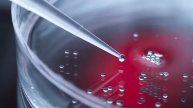 Rejuvenecieron 30 años las células de la piel de una mujer con tecnología de la oveja Dolly