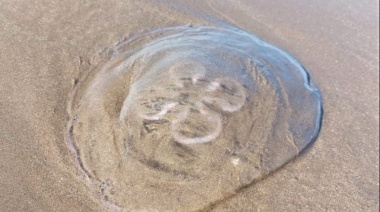 Picadura de aguas vivas: cómo evitar una dolorosa herida en el mar