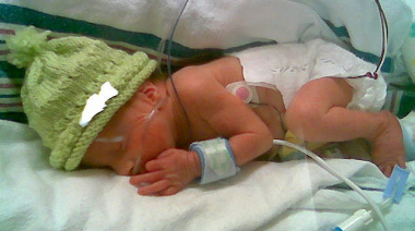 Sin médicos y sin red: el fin de un programa clave para bebés con cardiopatías