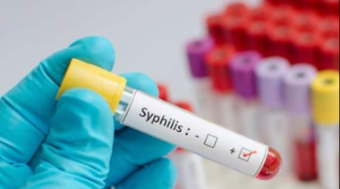 Alerta por el aumento de casos de sífilis en Argentina