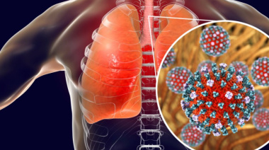 La Super Gripe H3N2 cobra su primera víctima en el país