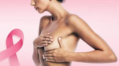 Cáncer de mama en Argentina: más de 20.000 casos al año y la importancia de la detección temprana