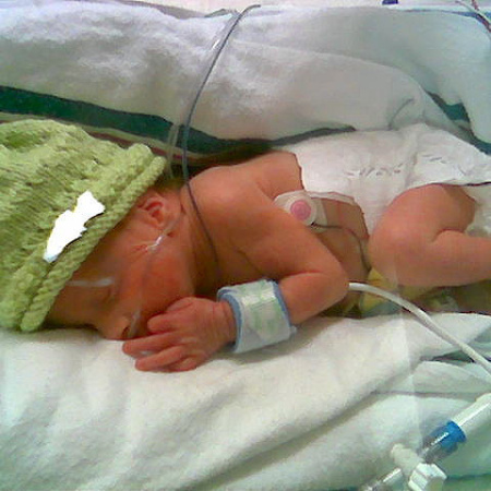 Sin médicos y sin red: el fin de un programa clave para bebés con cardiopatías