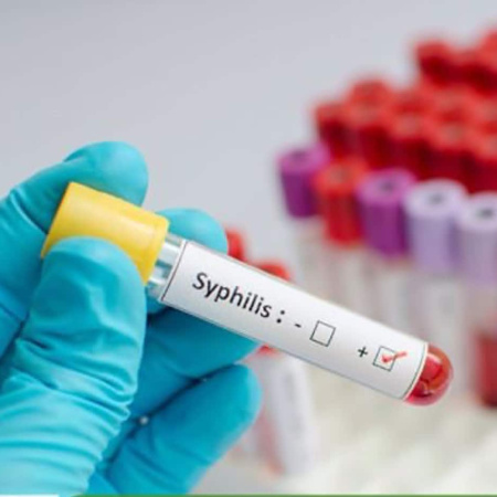 Alerta por el aumento de casos de sífilis en Argentina