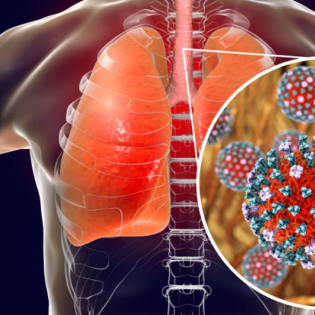 La Super Gripe H3N2 cobra su primera víctima en el país